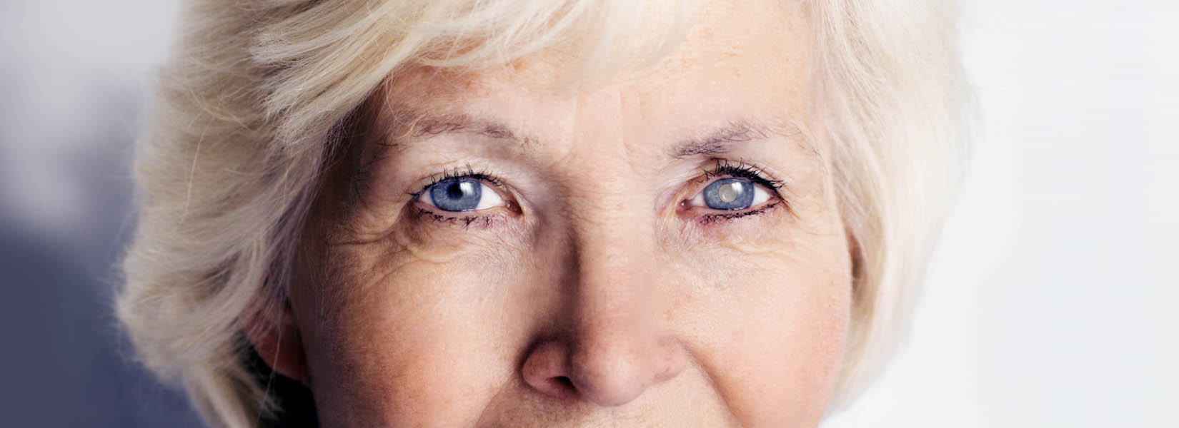 Cataract Surgery in Sandusky