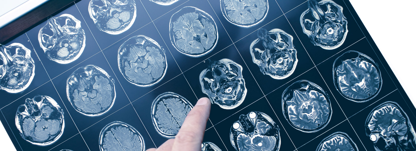 Neuro-Optometry in Sandusky